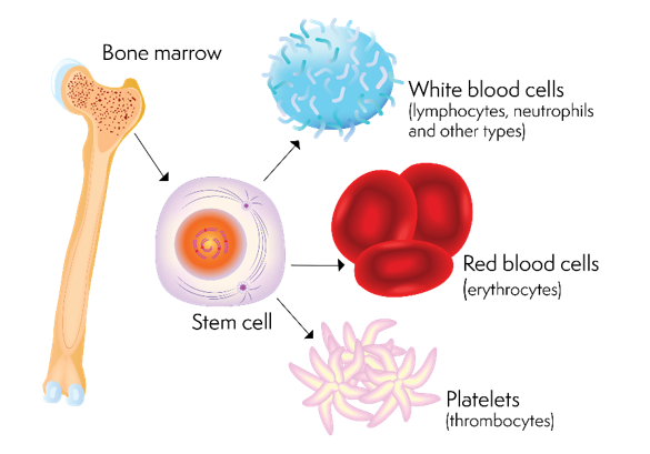 نتایج پیوند دومرحله‌ای سلول‌های بنیادی هاپلوایدنتیکال آلوژنیک در بیماران مسن دارای بدخیمی‌های خونی